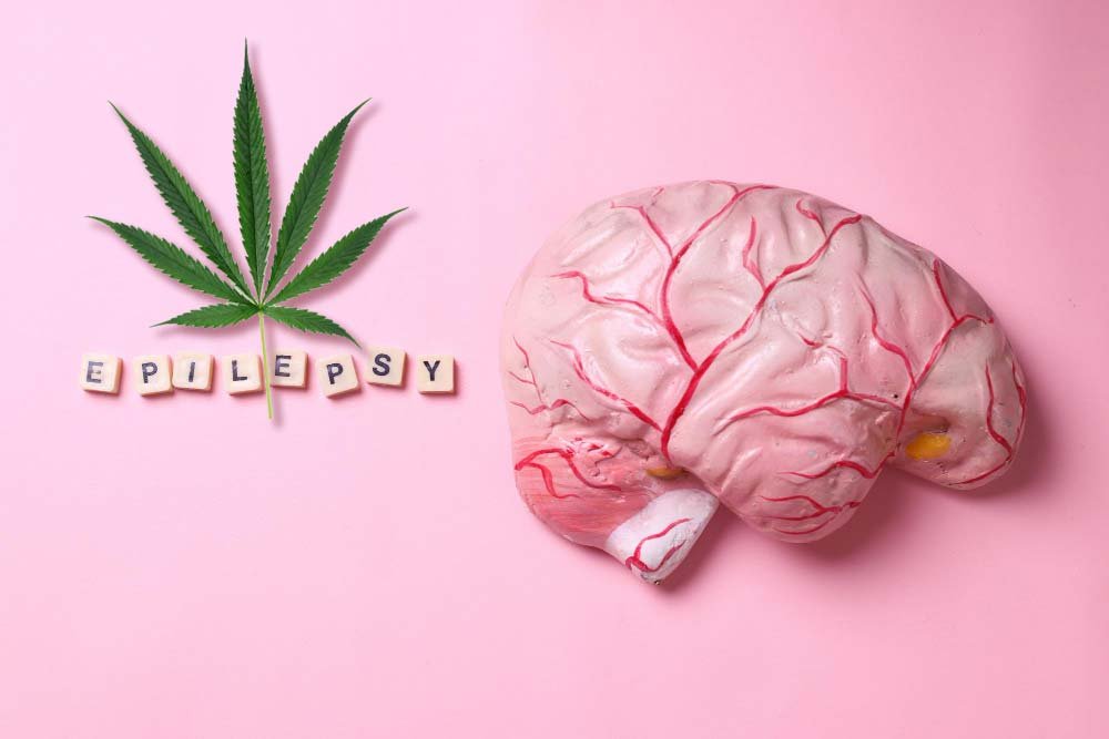 cbd y epilepsia